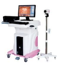 Digital Colposcope