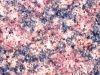 Granites