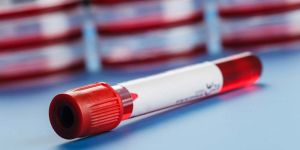 Non Vacuum Blood Collection Tube