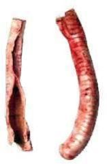 Offal (Top Honey Comb Trachea)