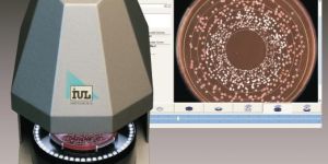 Automatic Colony Counter