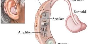 Hearing Aids