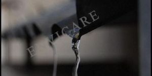 Rainwater Harvesting Filters