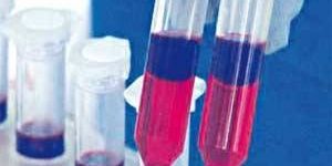 Milk Adulteration Kit