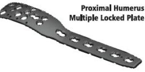Proximal Upper Limb Plate