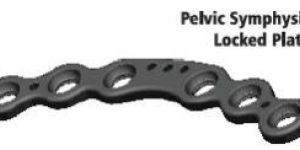 Symphysis Pelvic Plate