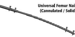 Universal Femur Intramedullary Nailing System
