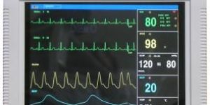 Multi Parameter Patient Monitor