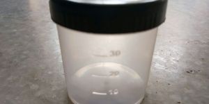 Sputum Containers