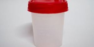 Urine Culture Bottle