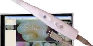 Dental Intraoral Camera