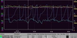 Combustion Control Systems