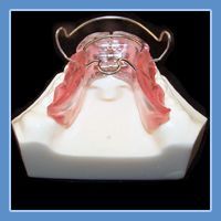 Orthodontic Appliances
