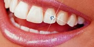Tooth Jewellery