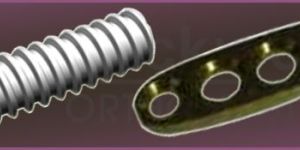 Arthroscopy Implants