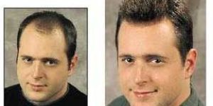 Mens Hair Weaving Services