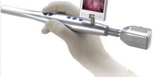 Wireless Intraoral Camera (Pd 800uwsl)