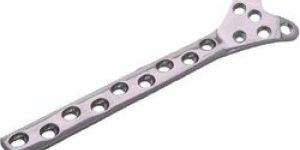 Condylar Buttress Plate