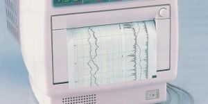 Fetal Monitor