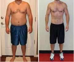 Weight Loss Treatment