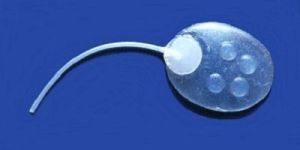 Surgical Glaucoma Shunt