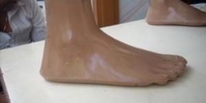 Jaipur Foot without Bolts