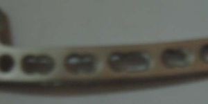 Lcp Locking Distal Humerus Horse with Support