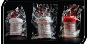 Sterile Urine Sample Containers