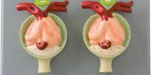 Nephron Diseases Model