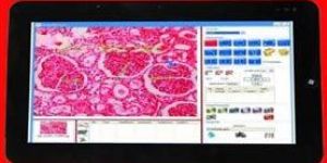 Metallurgical Software