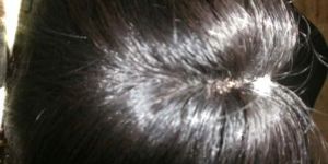 Hair Wig
