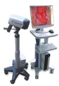 Digital Video Colposcope