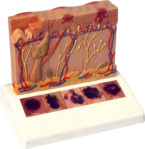 Skin Cancer Model