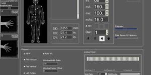 Computed Radiography System