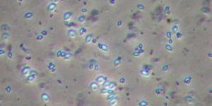 Bacillus Thuringiensis