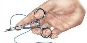 Disposable Surgical Suture