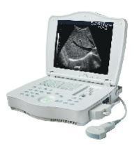 Ultrasound Scanner