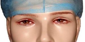 Back Elastics Surgeon Cap