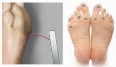 Monofilament