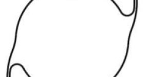 Posterior Chamber Lenses