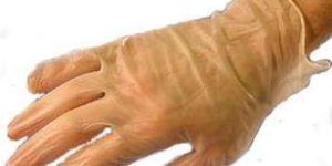 Disposable Vinyl Gloves