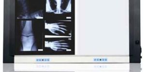 X Ray View Box