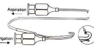 Posterior Capsule Polisher
