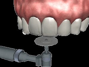 THE TOOTH - WAITING AREA DVD