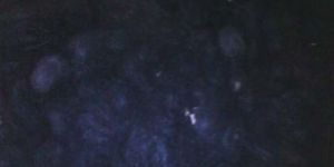 Combo Ball Waste Human Hair