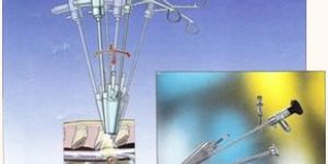 Laminectomy Instruments