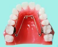 Orthodontic Appliances