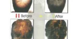 Fibro Hair Building Fiber