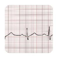 ECG Paper