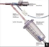Ultrasonic Surgical Aspirator